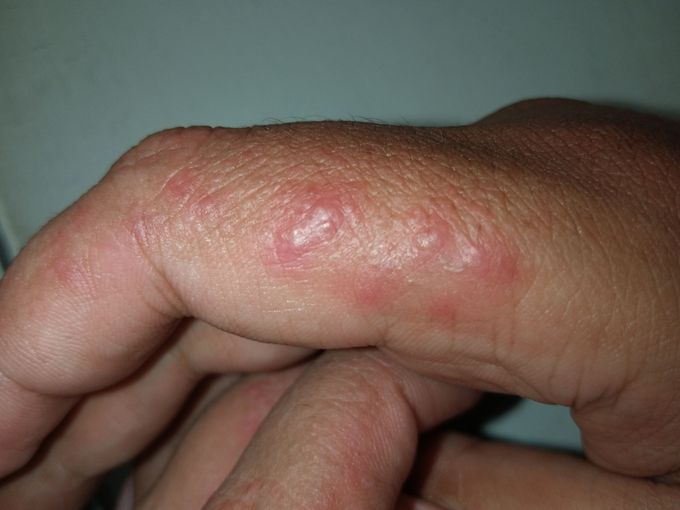 Diagnose.