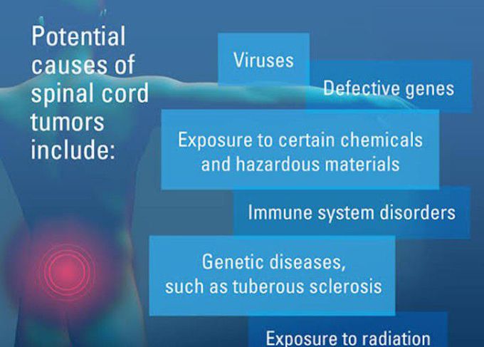 What causes spinal cancer?