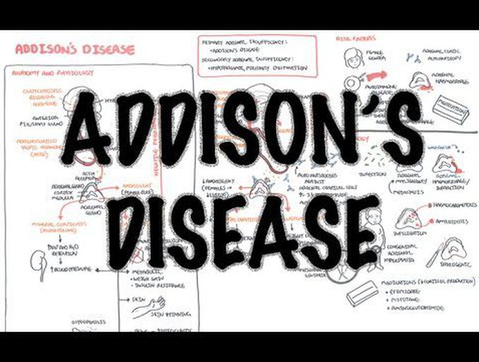 Addison's Disease