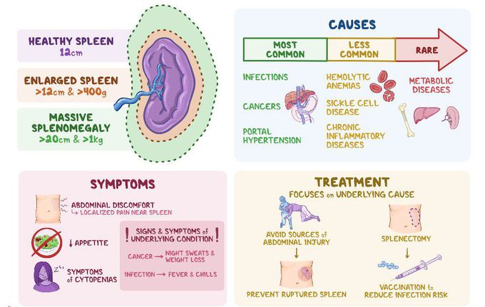 Symptoms of Splenomegaly