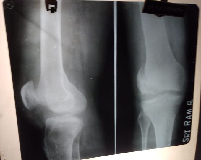 Xray
