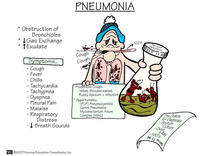 Pneumonia