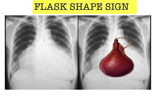 Flask Shape Sign