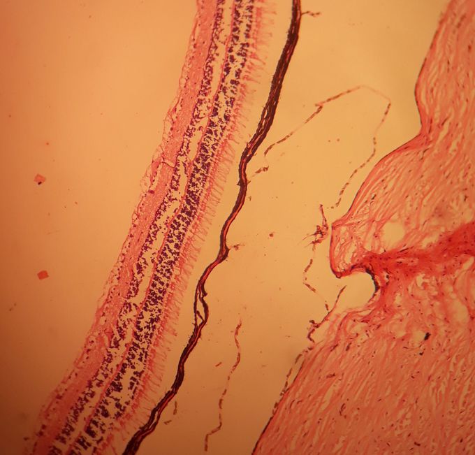 3 layers of eyeball: sclera,choroid,retina