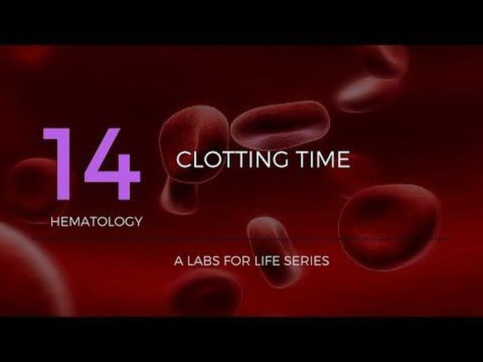 Lab performance of clotting time test