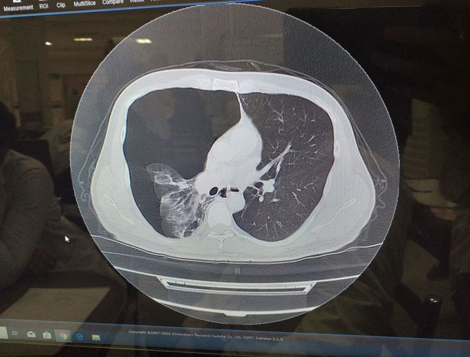 What is your diagnosis?