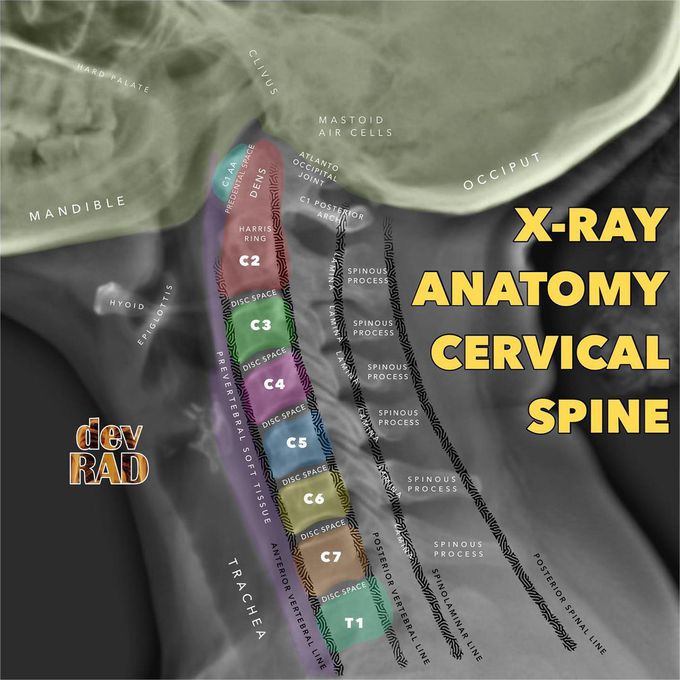 Anatomy of Cervical Spine