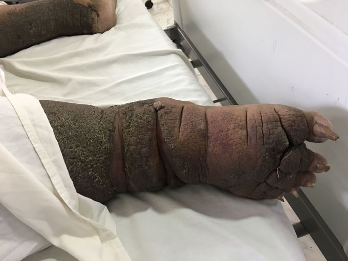 What’s the diagnosis?