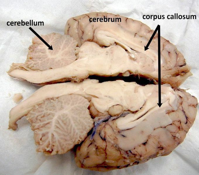 BRAIN DISSECTION