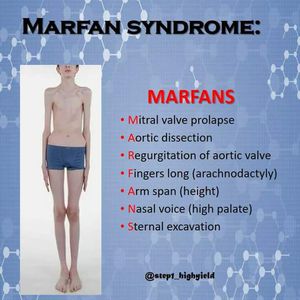 Marfan syndrome featurea - MEDizzy
