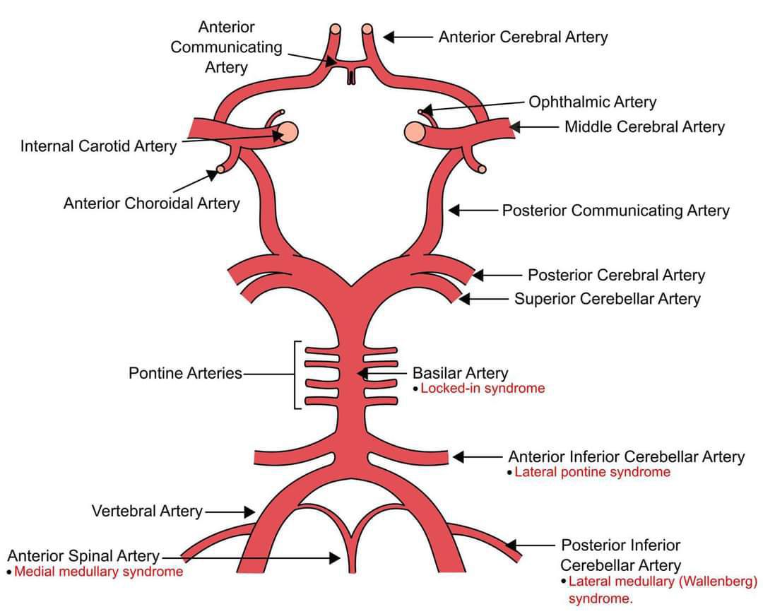 Circle of Willis - MEDizzy