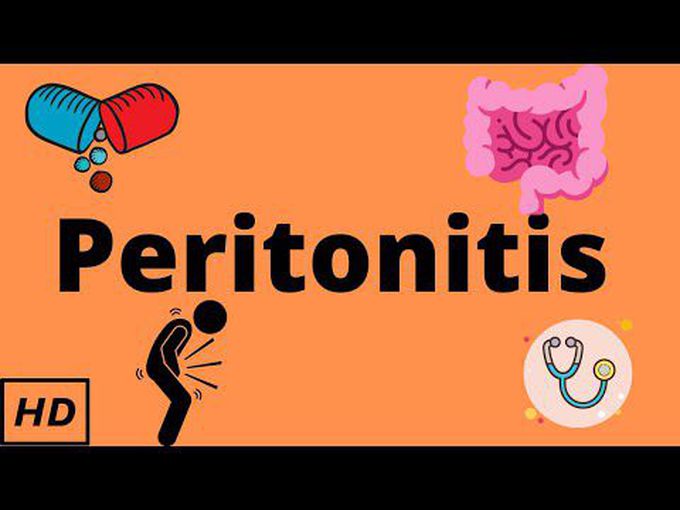 Peritonitis: Overview