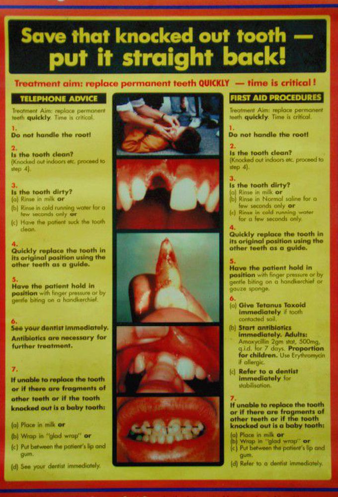 First aid of Avulsion