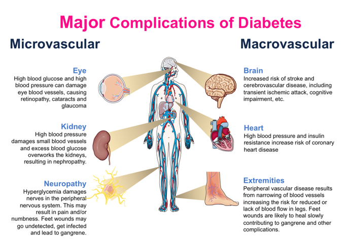 Complications of diabetes.
