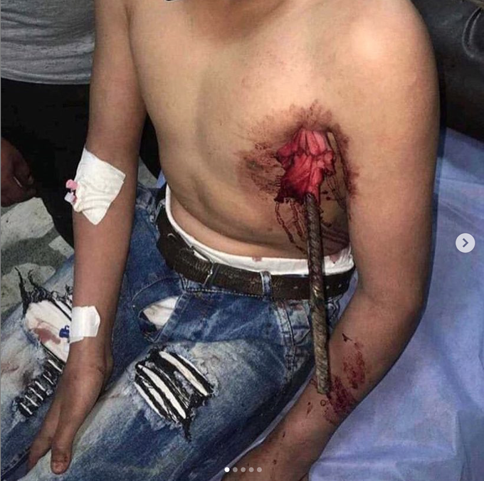Impaled on a metal beam!!