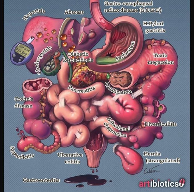 Most diseases happenin the abdominal cavity..!