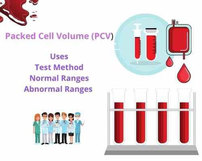 Packed Cell Volume (PCV): Uses, Test Method, Normal and Abnormal Ranges by Nurses Note