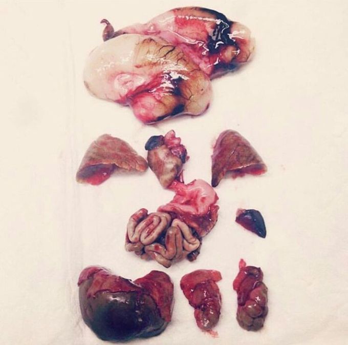 Fetal Organs!