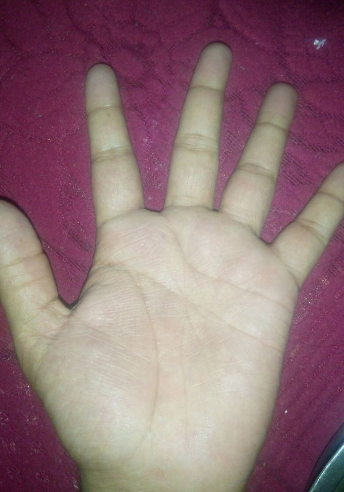 Red and itchy skin. What is your diagnosis and treatment???