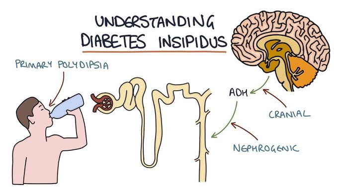 Kidney Diseases VII-
Diabetes Insipidus