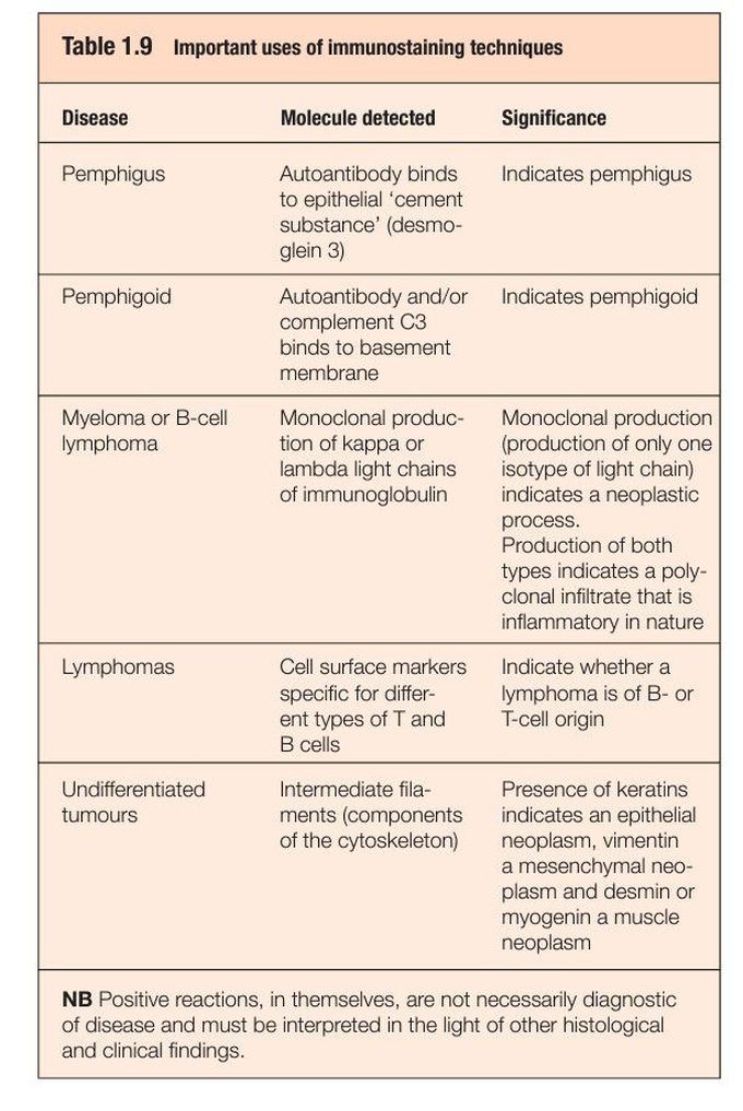 Immunostaining diagnosis