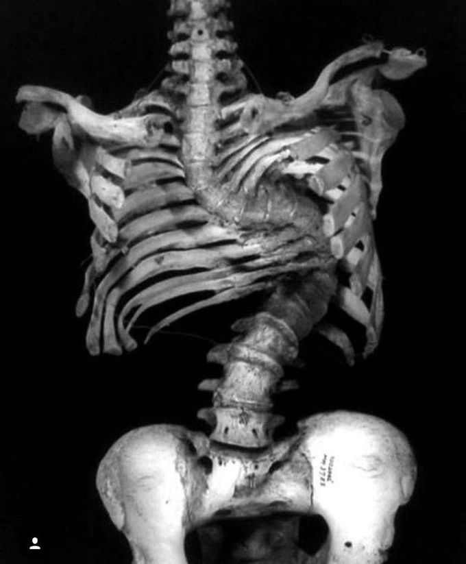 What is your diagnosis??
