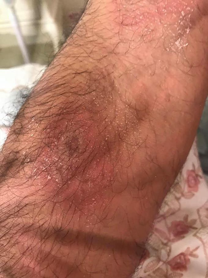 DIAGNOSIS ?