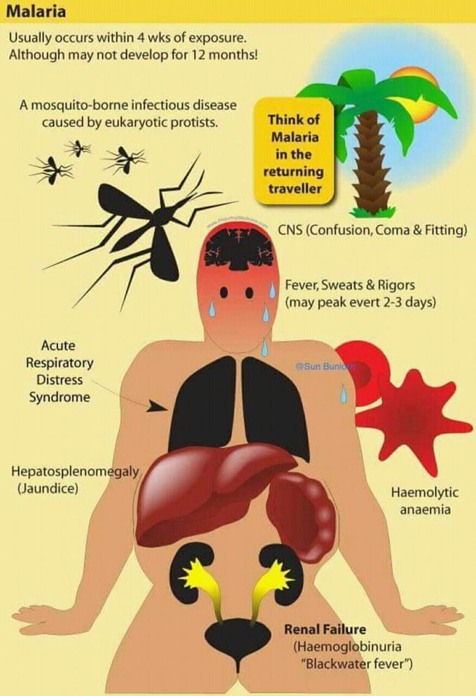 Malaria