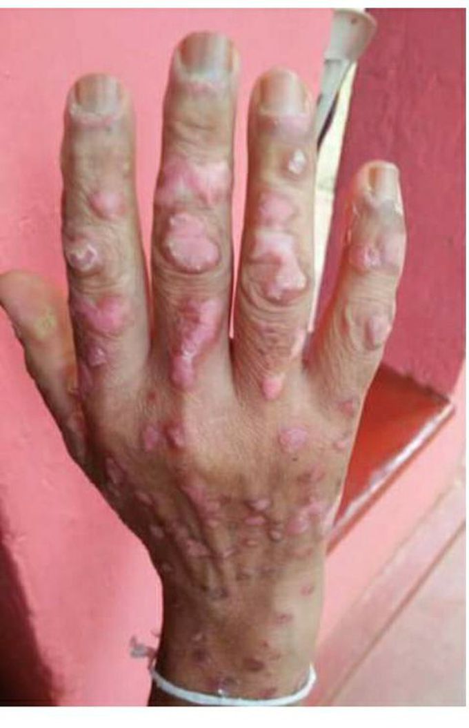 Diagnosis pls ?