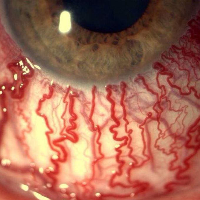 Closeup view of a human eye