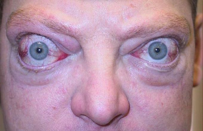 What is the name of this condition??