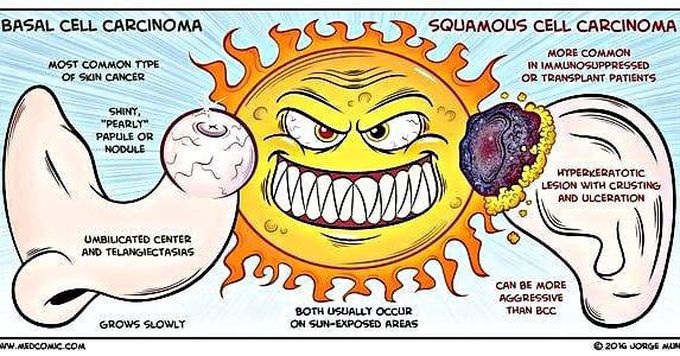 Difference between basal cell carcinoma and squamous cell carcinoma .