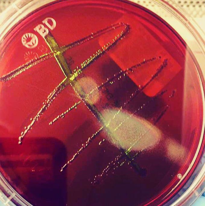 Microbiology❤️