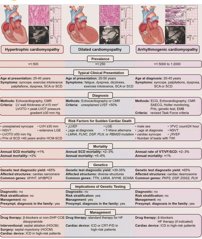 Types of Cardiomyopathy