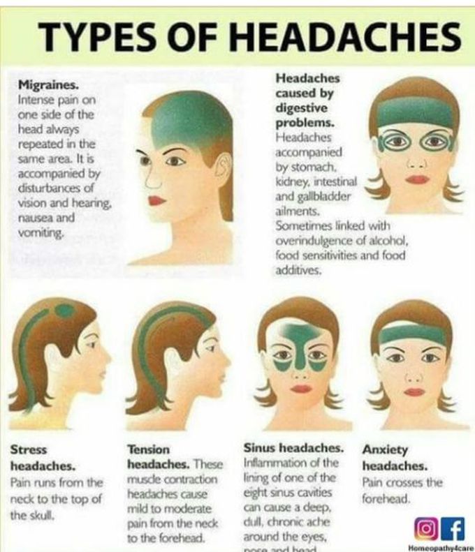 Type's of headache