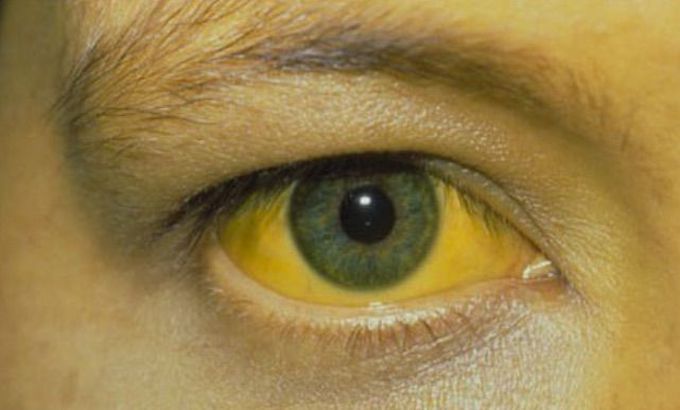 Diagnosis??