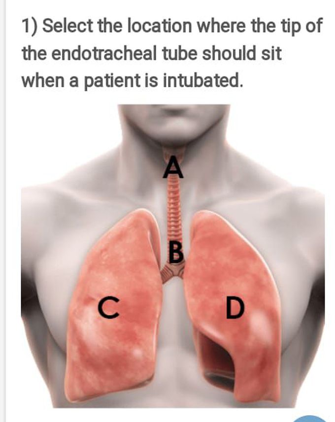 Answer location of endotracheal tube?