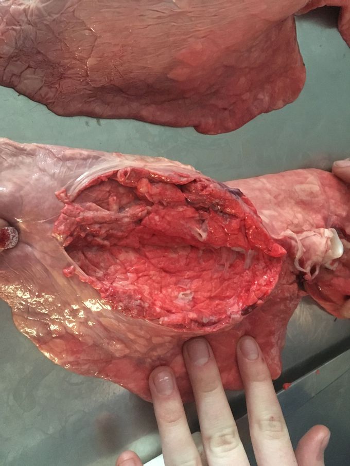 Lungs