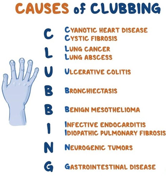Causes of Clubbing