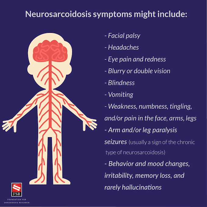 Symptoms of neurosarcoidosis