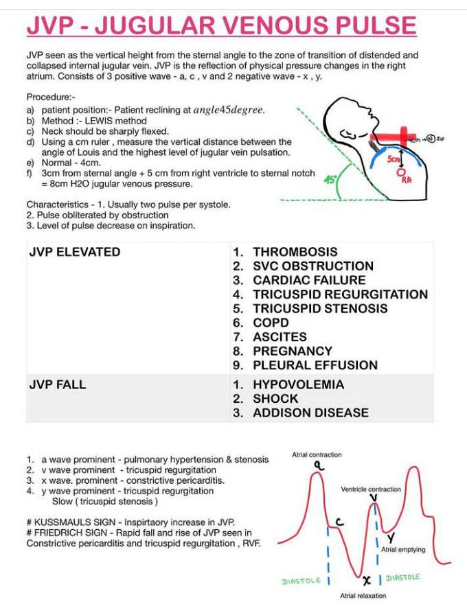 Sternal Angle Jvp