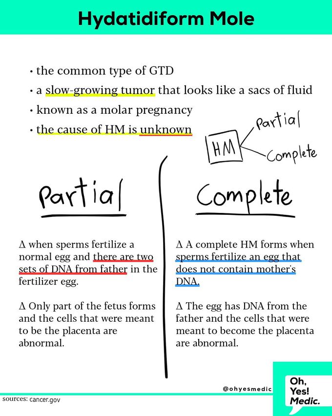 Hydatidiform Mole Cancer (Molar Pregnancy)