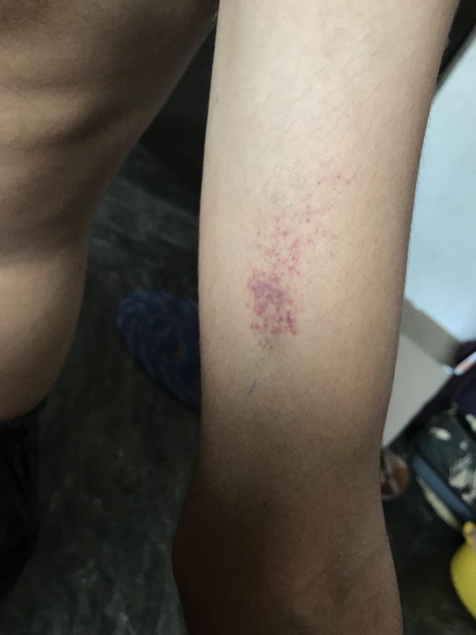 Diagnosis?