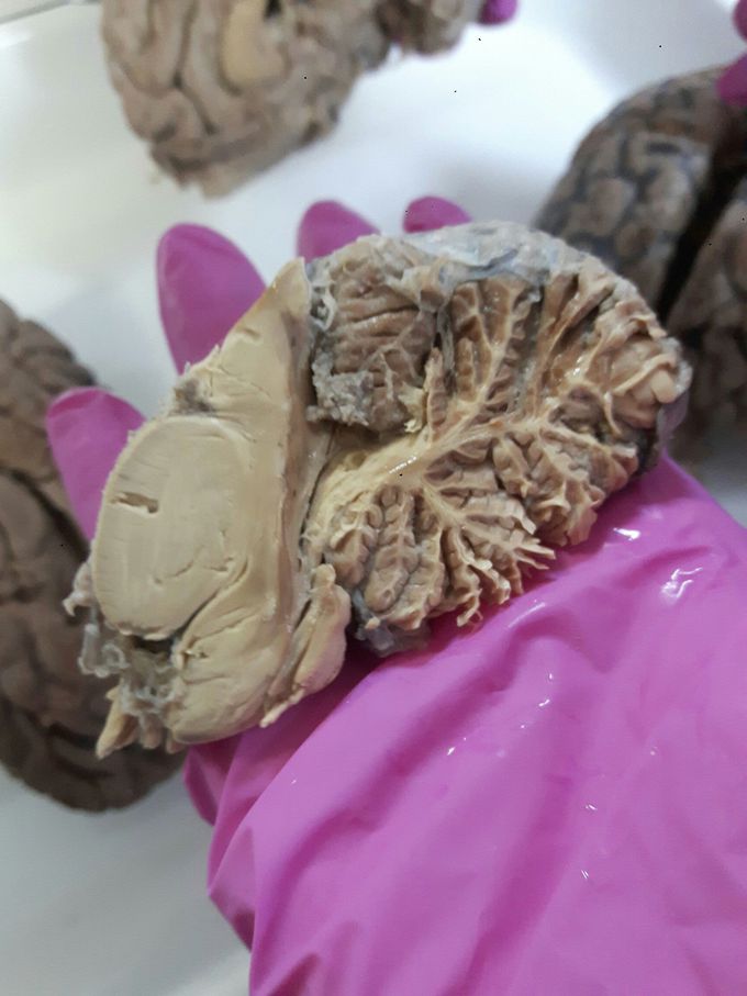 Cerebellum