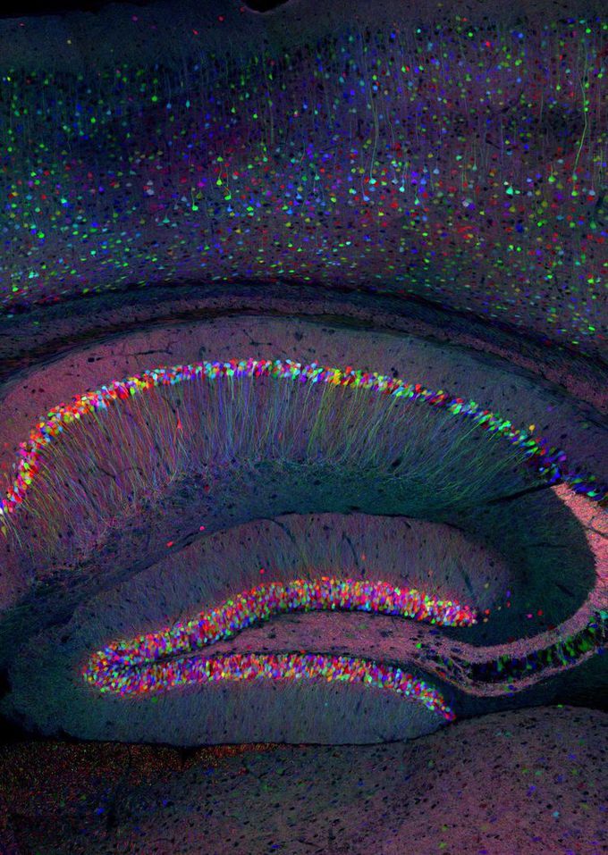 Brain
