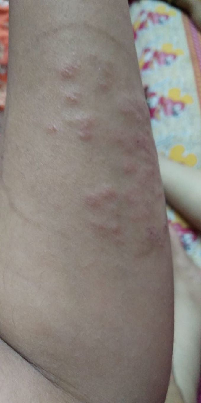 What is your diagnosis and treatment???