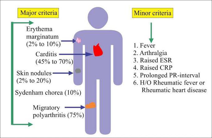 rheumatic-fever-medizzy
