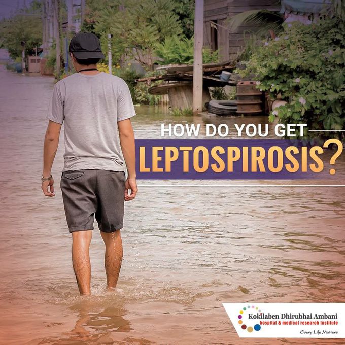 Leptospirosis