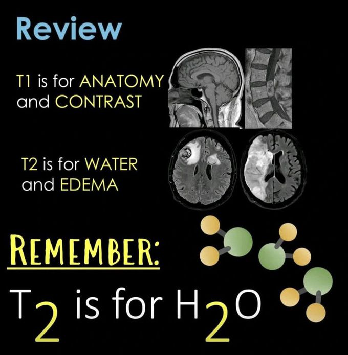 How to Read MRI V