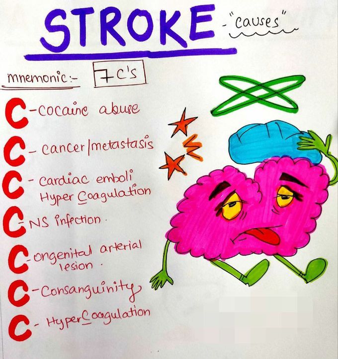 Stroke heart